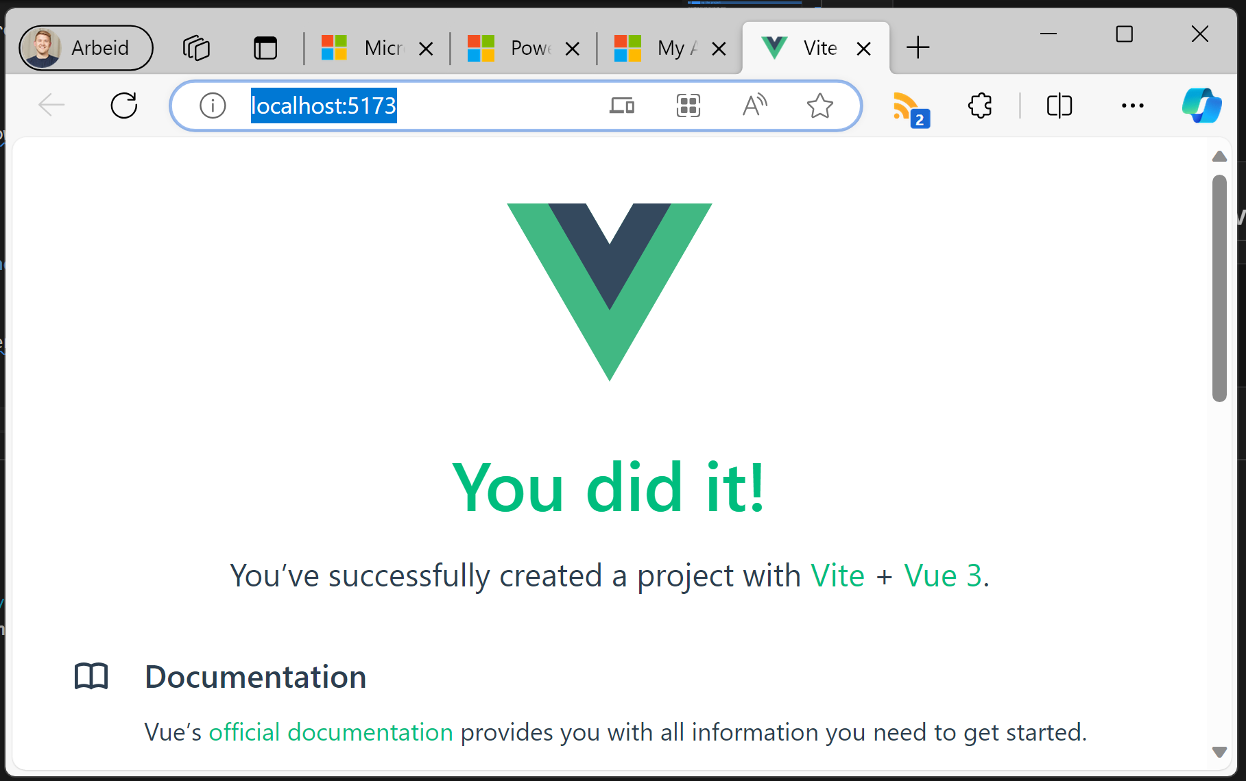 Vue.js dev server running in the browser on localhost:5173